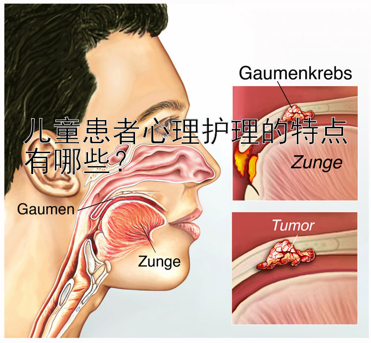 儿童患者心理护理的特点有哪些？